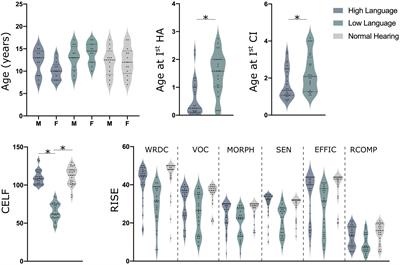 Dynamic networks differentiate the language ability of children with cochlear implants
